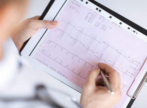 İşyerlerinde EKG’nin Önemi ve Yararları