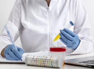 İşyerlerinde Tam İdrar Testinin Önemi ve Yararları