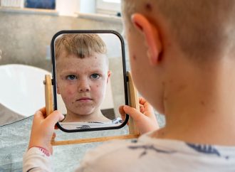 Kızamık ve Kızamık Aşısı