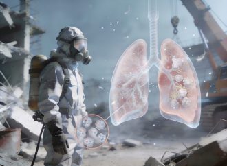 İş Hijyeni ve Meslek Hastalıkları Perspektifinden: Asbest